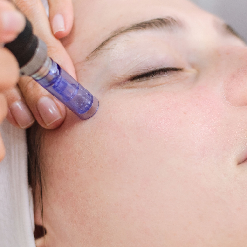 Микронидлинг (DermaPen)фракционная мезотерапия+ узе чистка