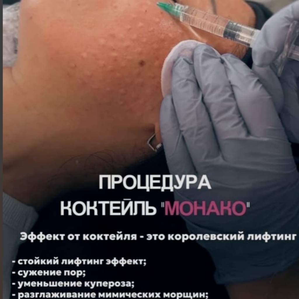 Минако. Био + ботокс
