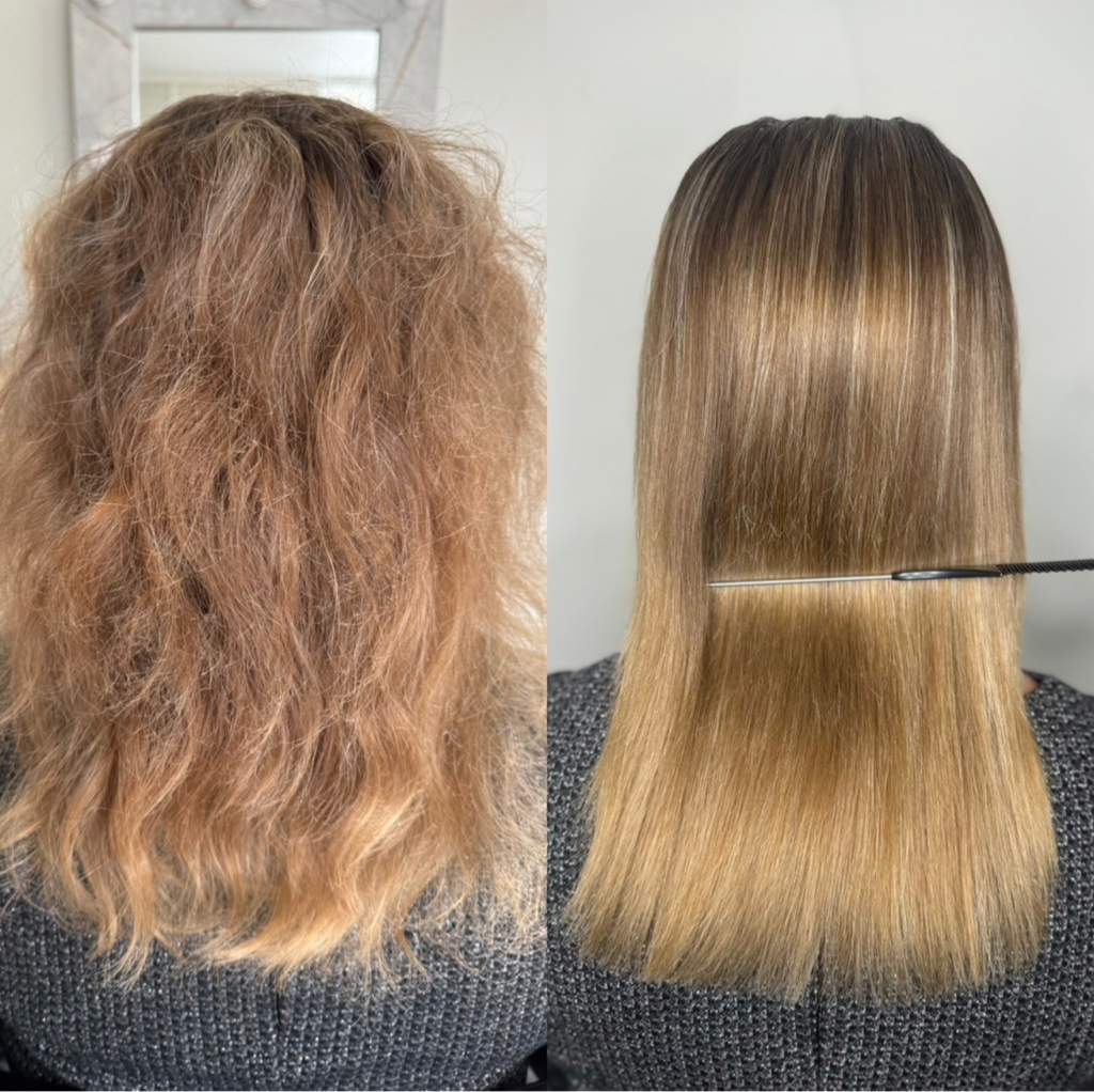 Биксипластия