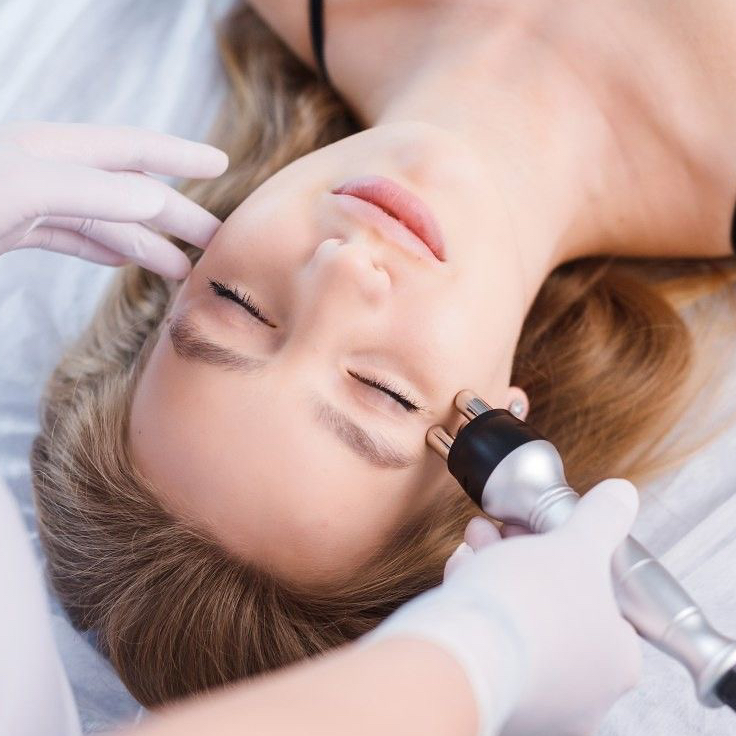 RF-лифтинг лица