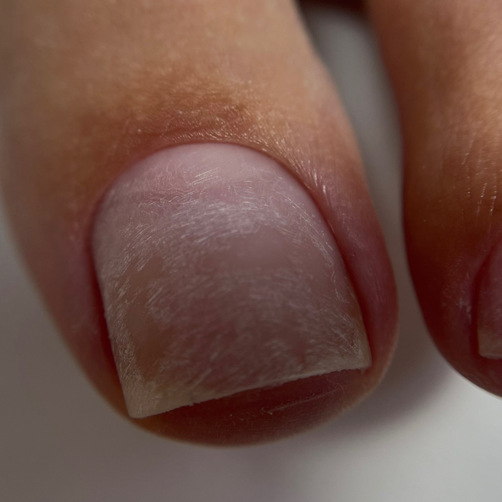 Обработка пальчиков без покрытия