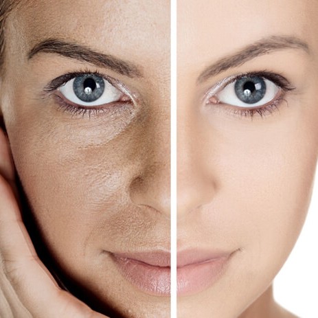 Ботоэффект