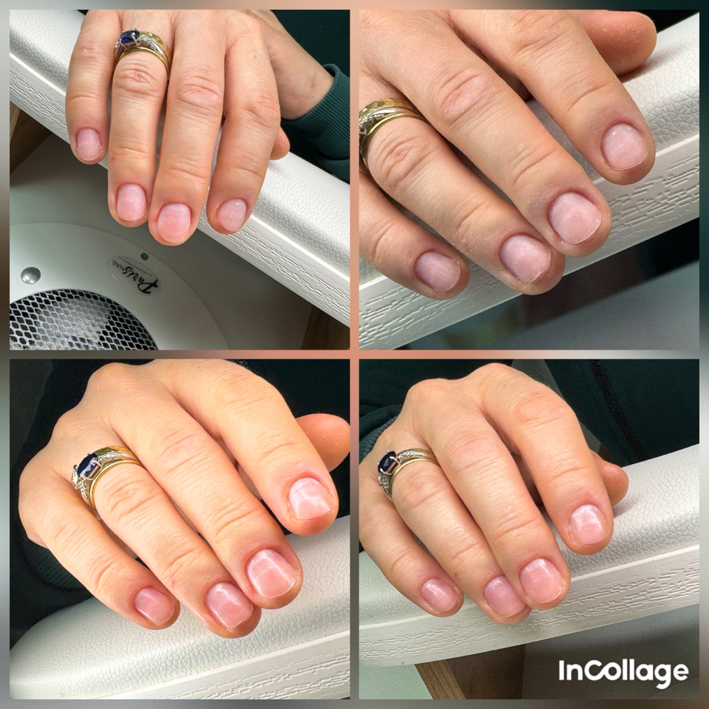 Снятие без последующего покрытия