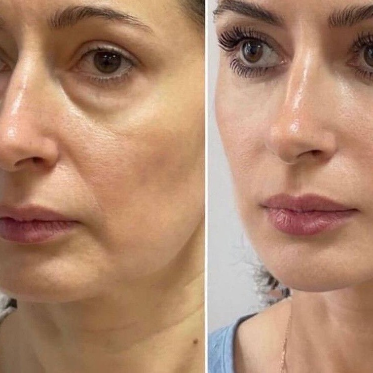 Подбородок