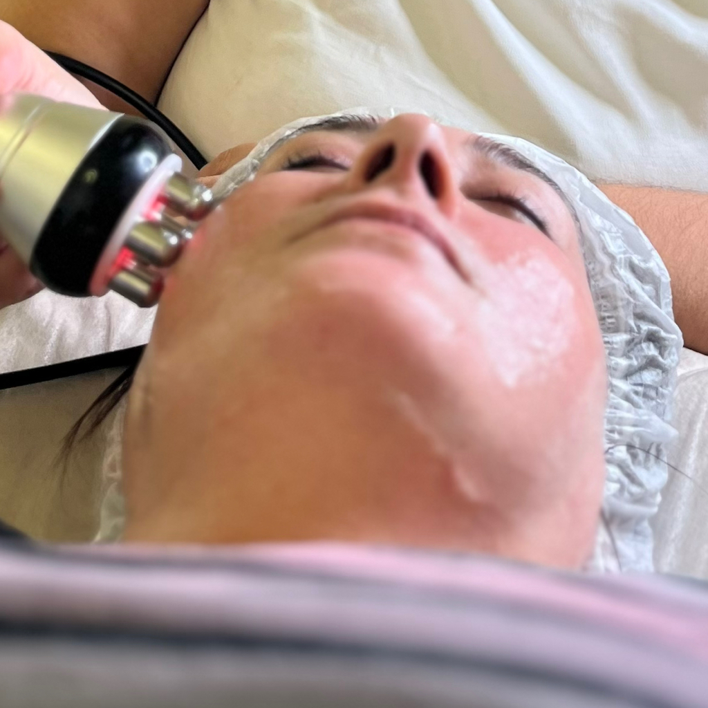 Rf-лифтинг лица 40 мин