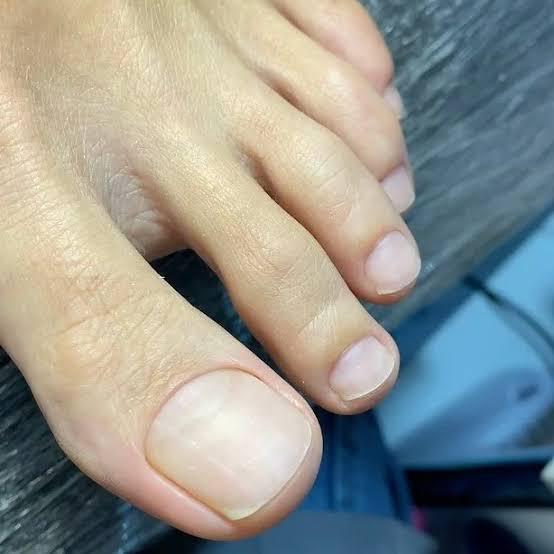 Мужской  кислотный педикюр (пальчики ,стопы)