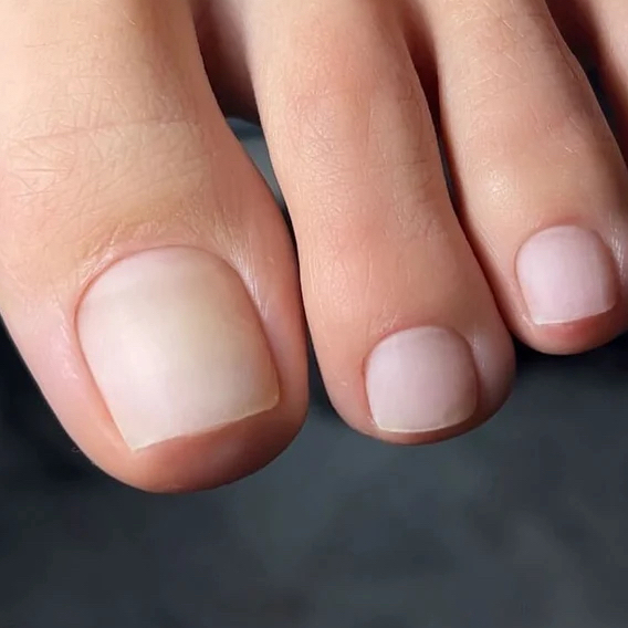 Полное снятие покрытия в педикюре без дальнейших процедур (с опилом формы)