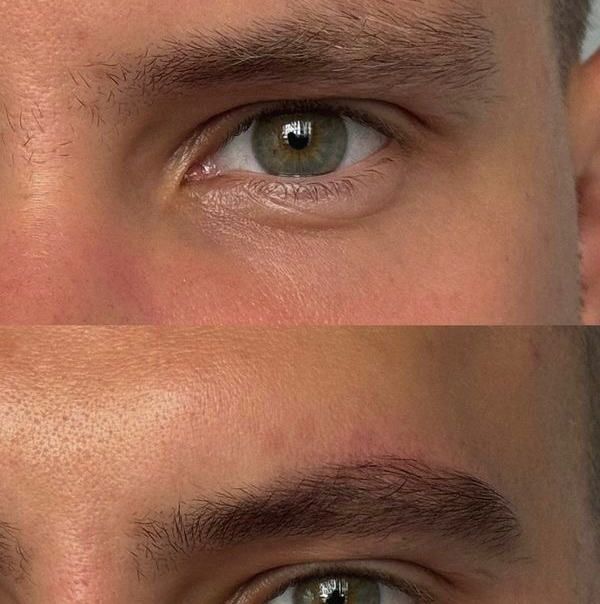 Мужская коррекция