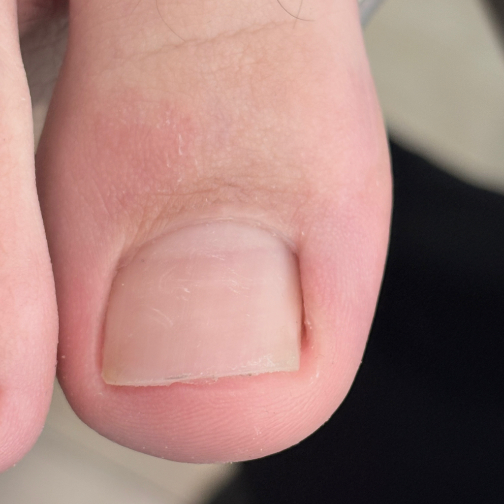 Обработка пальцев ног