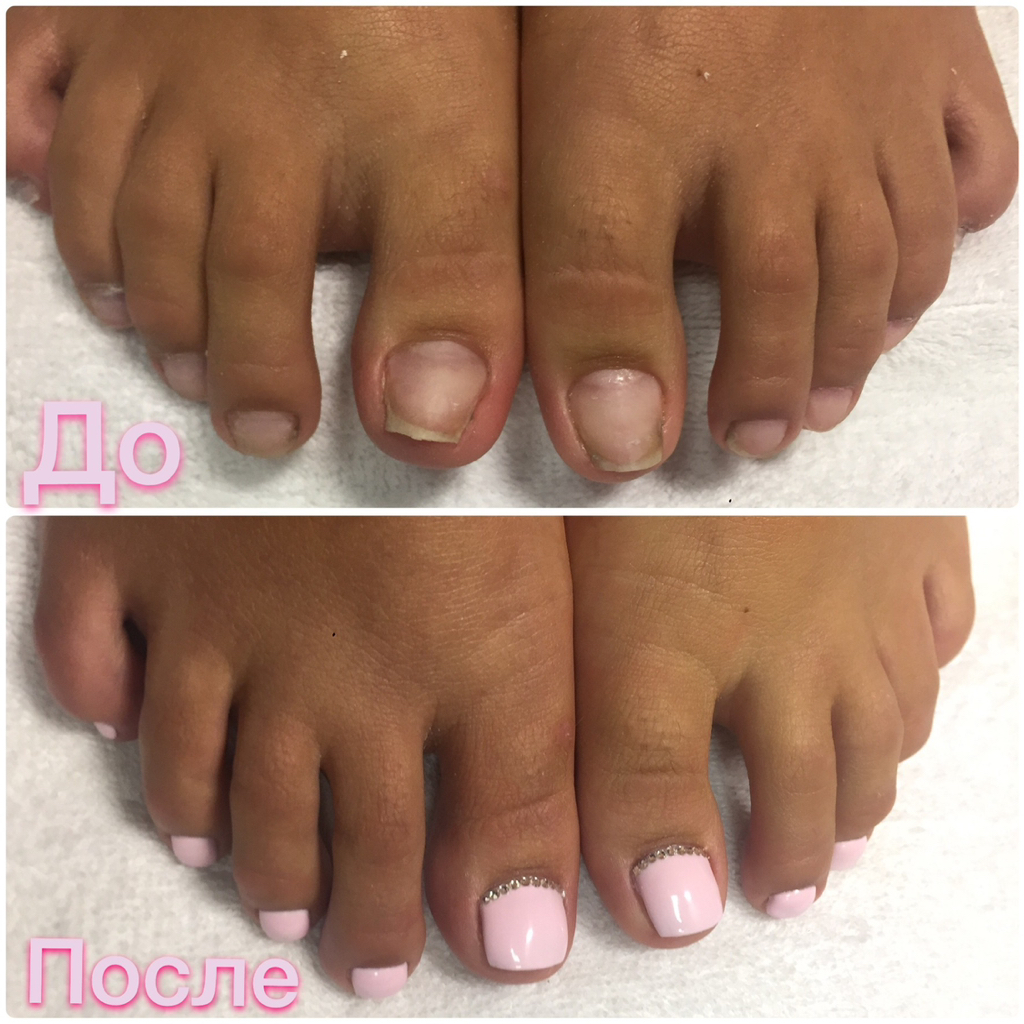 Полу педикюр с покрытием гель-лака (пальчики только)