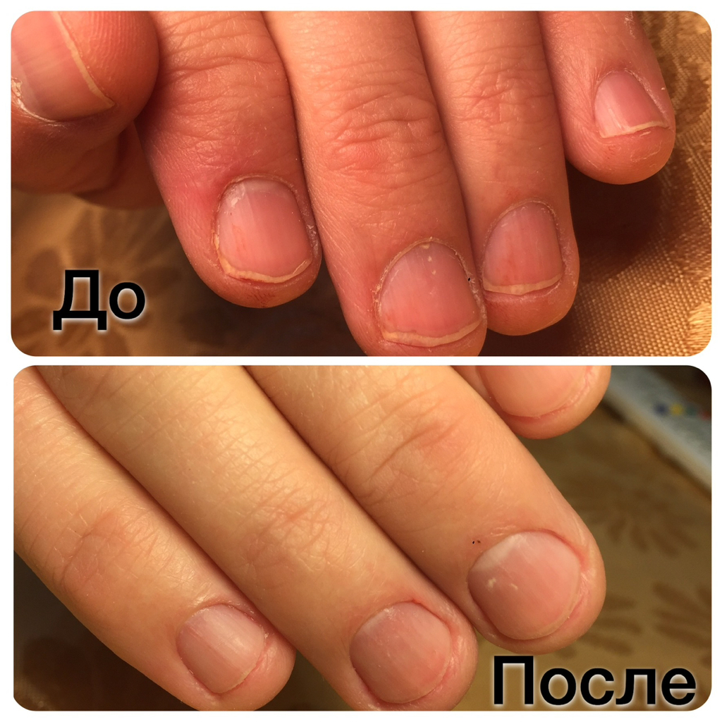 Мужской маникюр