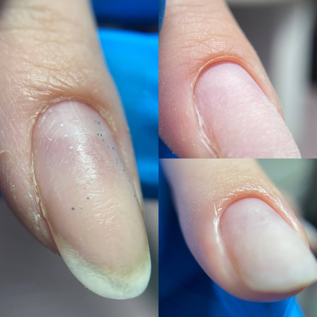 Комбинированный маникюр