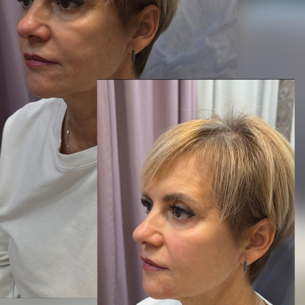 Жидкие нити