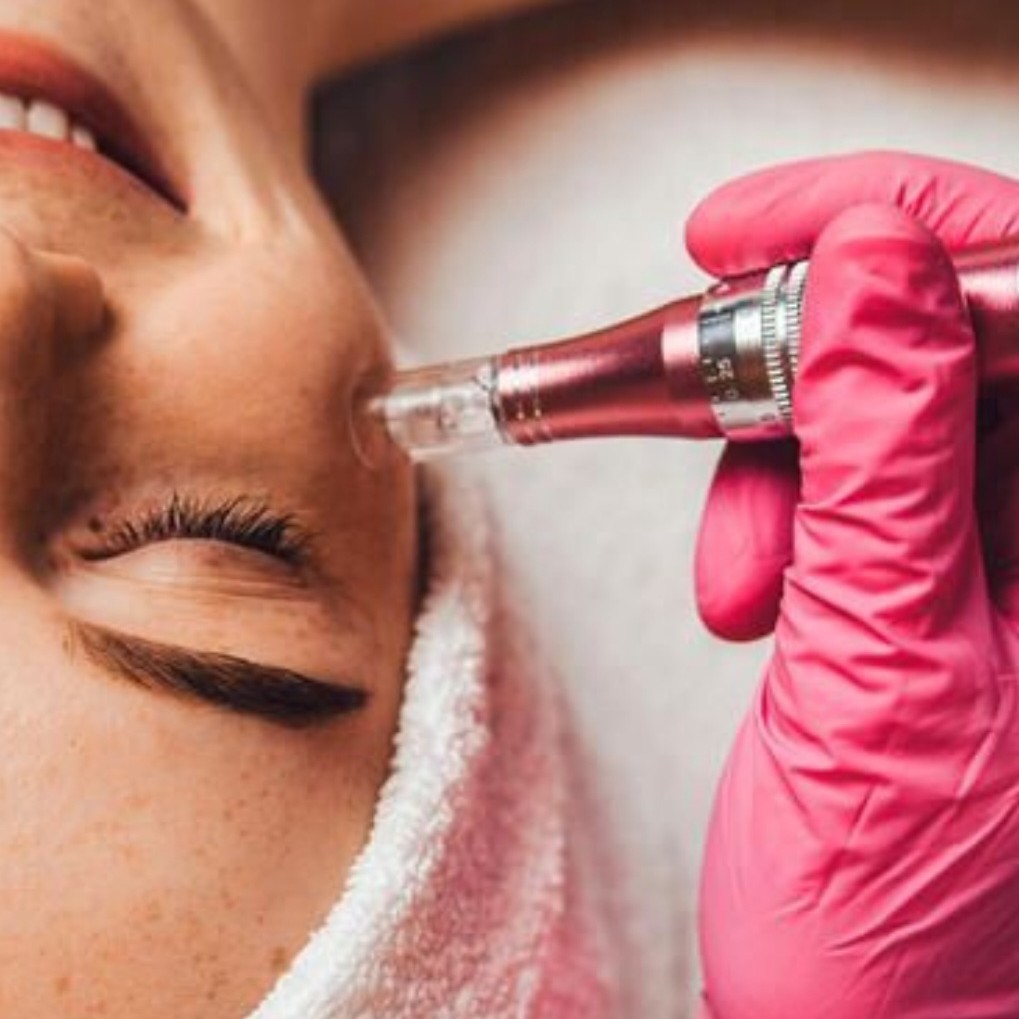 NEW Фракционная мезотерапия лицо+ шея