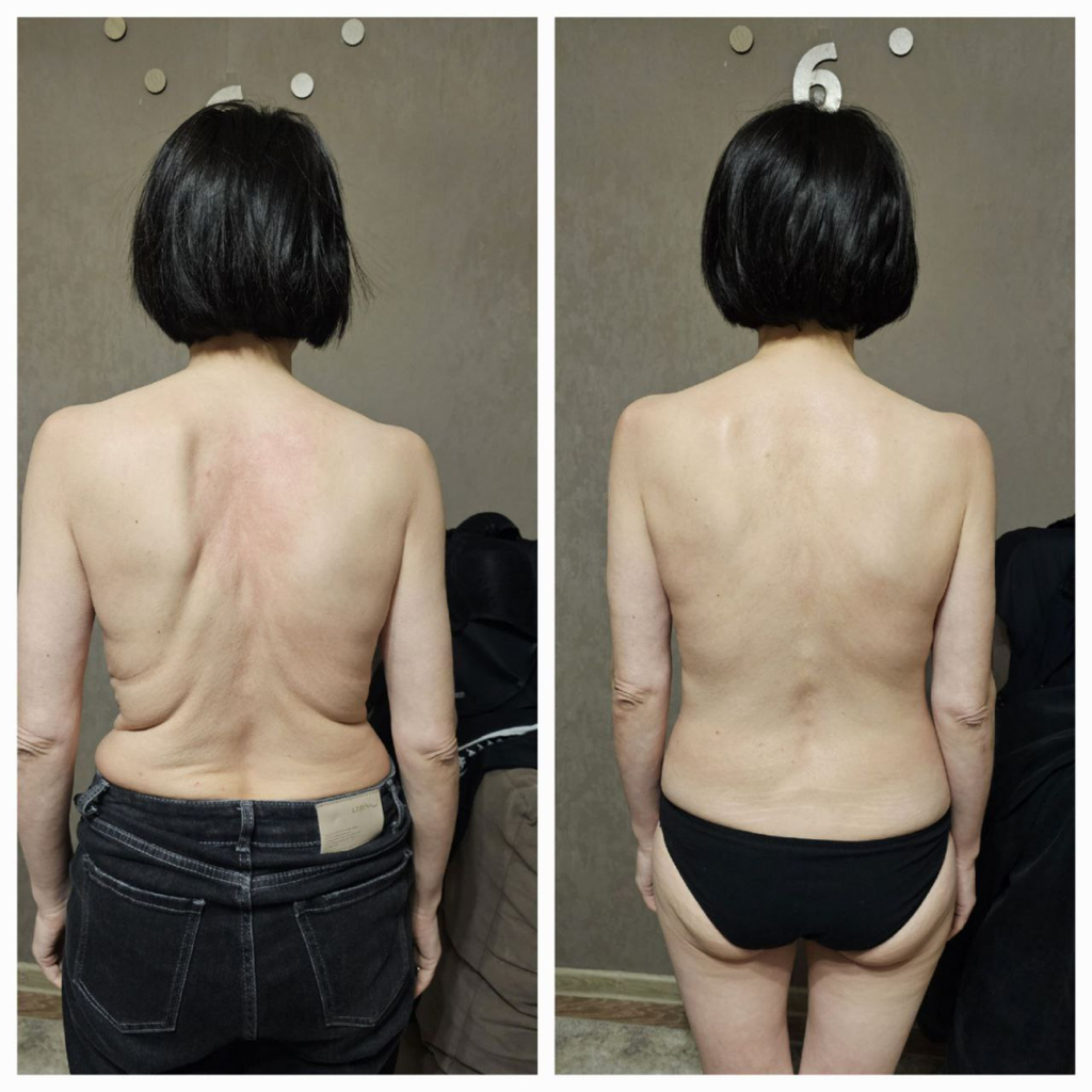 МАССАЖ ТЕХНИКА ИГЛОУКАЛЫВАНИЯ  ,,ДЫХАНИЕ ДРАКОНА,, 40 минут проработка проблемных зон