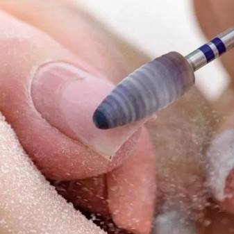 СНЯТИЕ НАРОЩЕННЫХ НОГТЕЙ