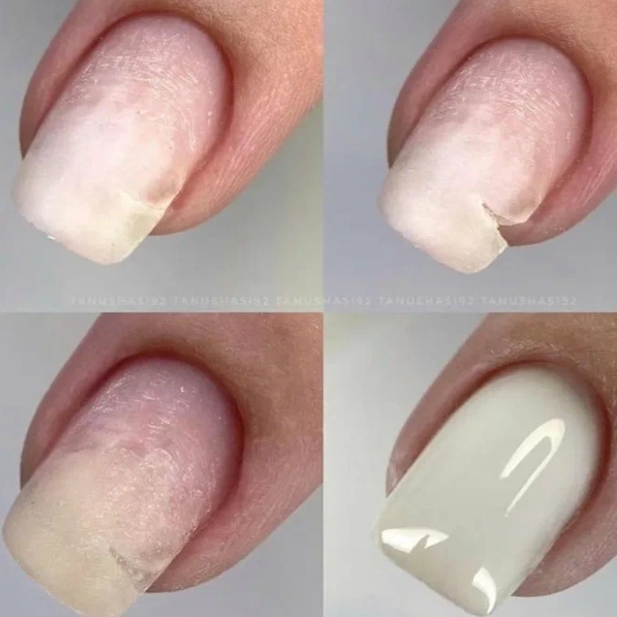 РЕМОНТ НОГТЯ