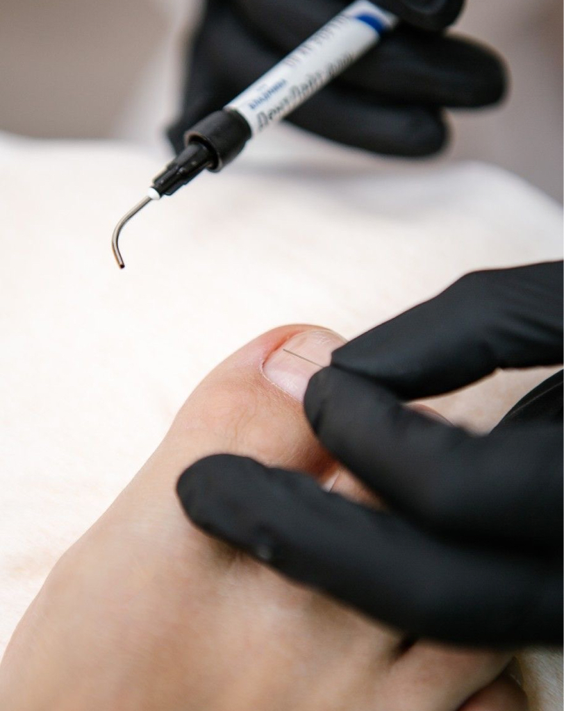 Комплекс с титановой нитью