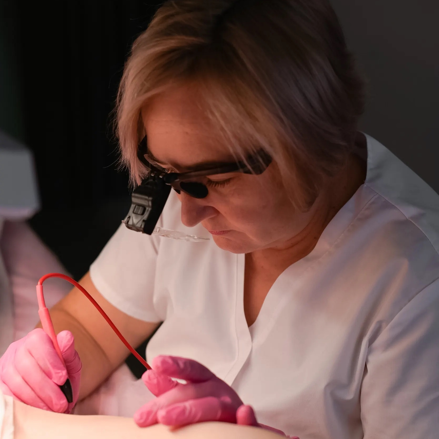 Электроэпиляция линии живота