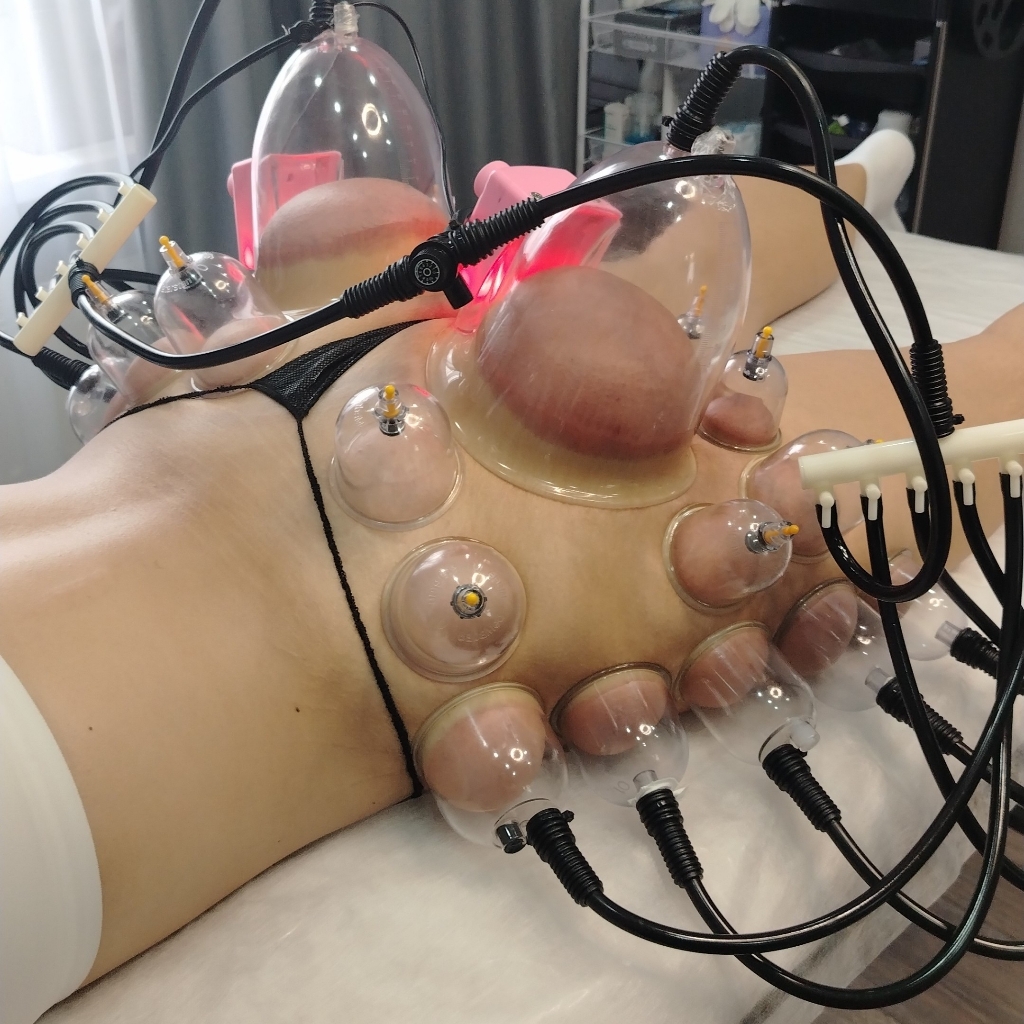 Паук бедра, ягодицы+ваккум