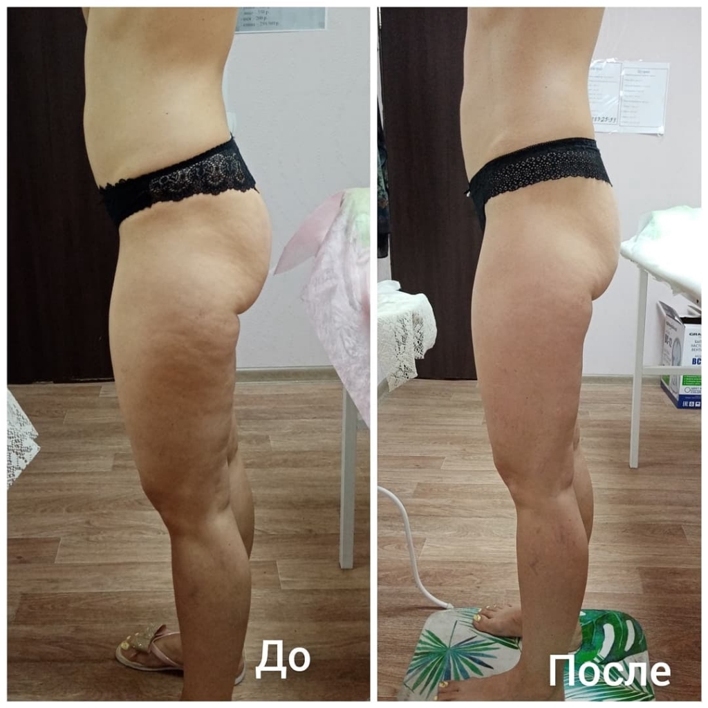 Медовый бедра +ягодицы