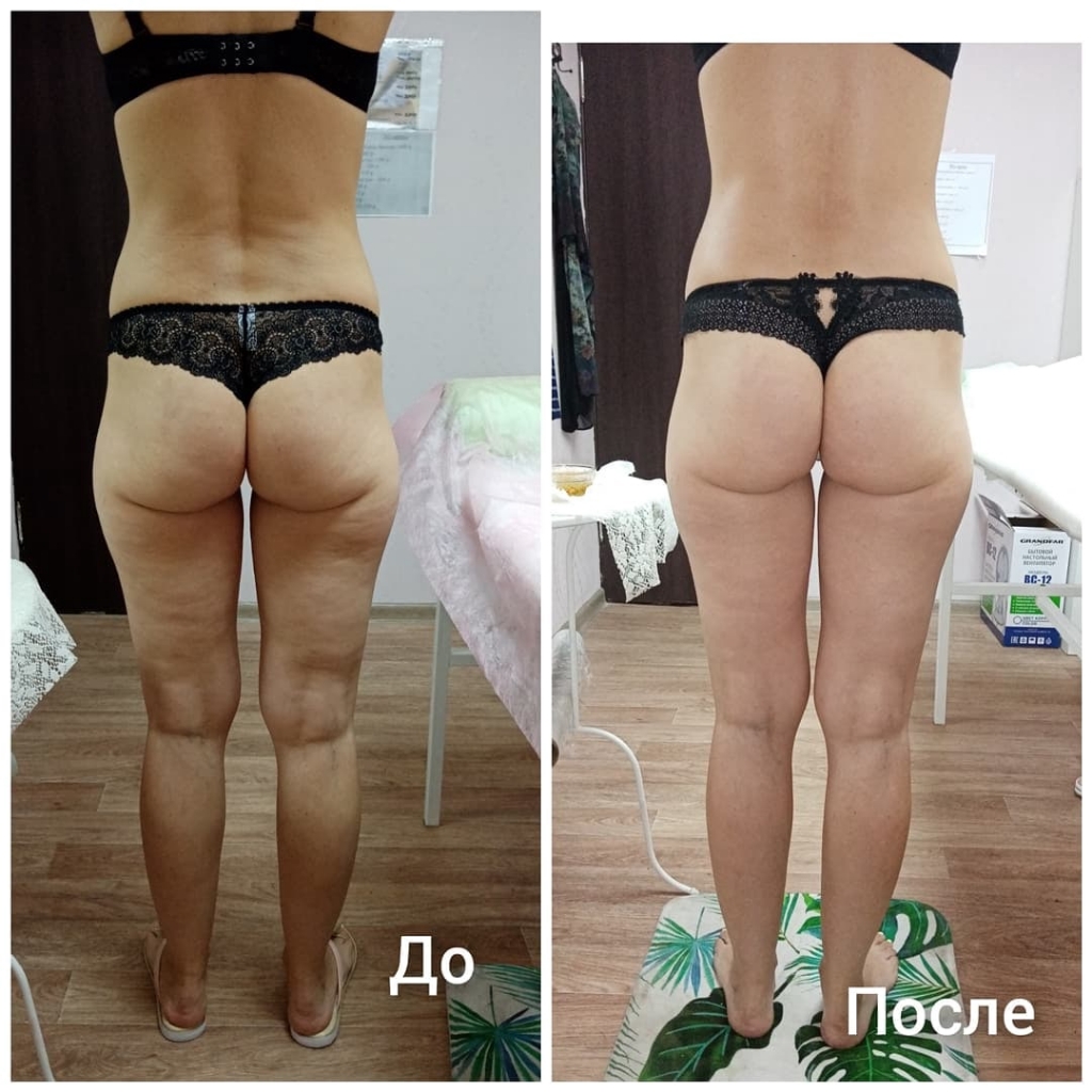 Медовый массаж общий