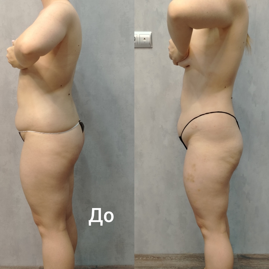 Паук живот, бока+ваккум