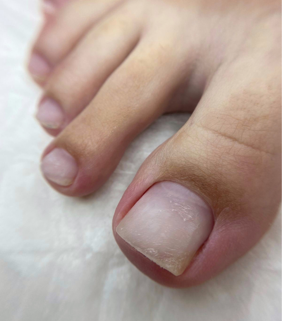 Педикюр Классический