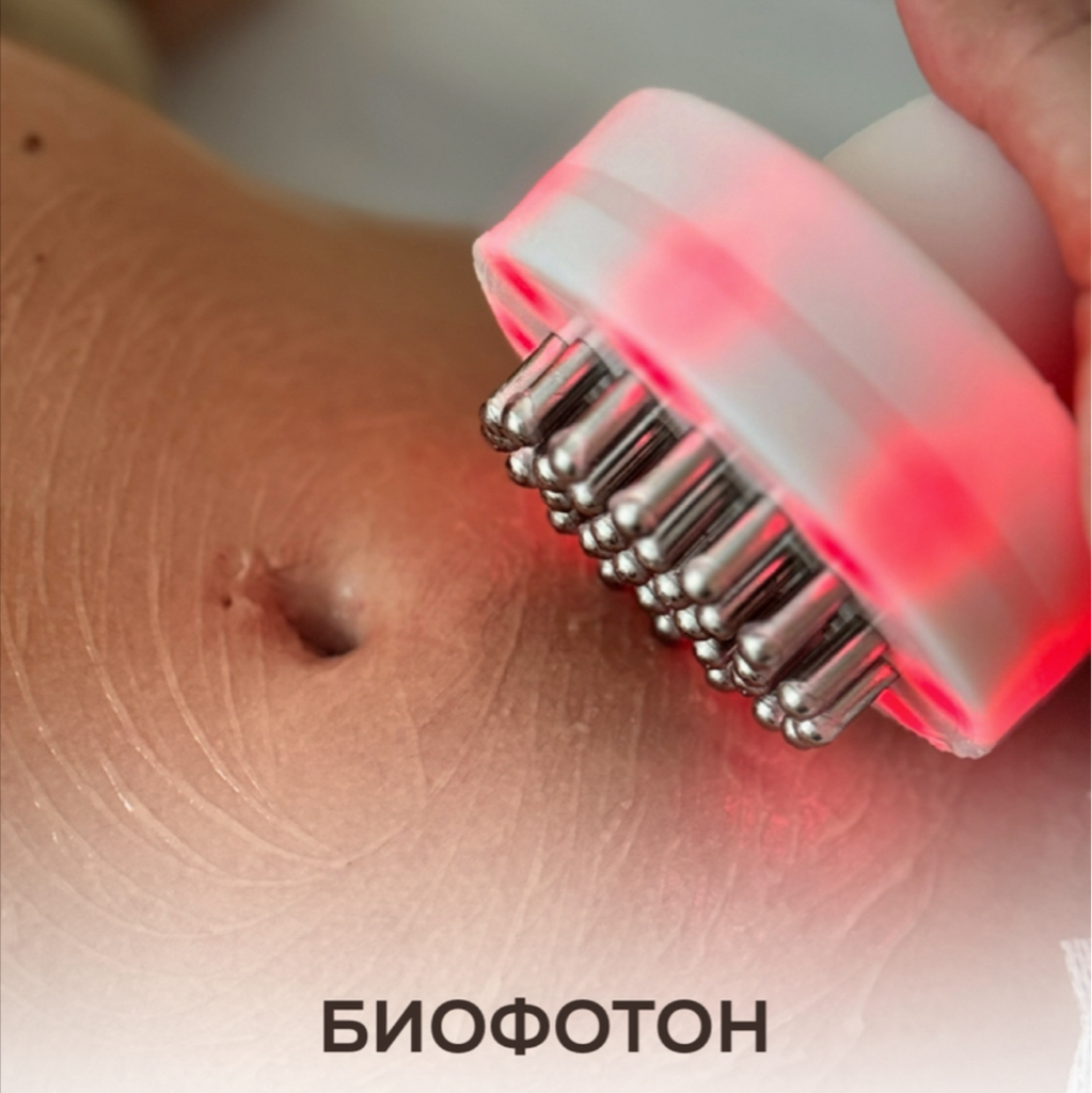Биофотон