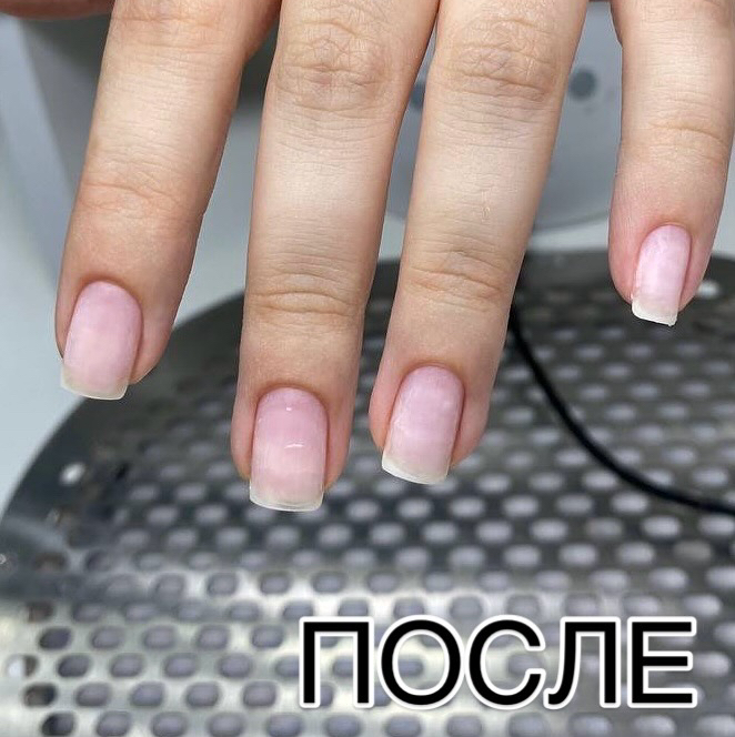 Укрепляющая система IBX