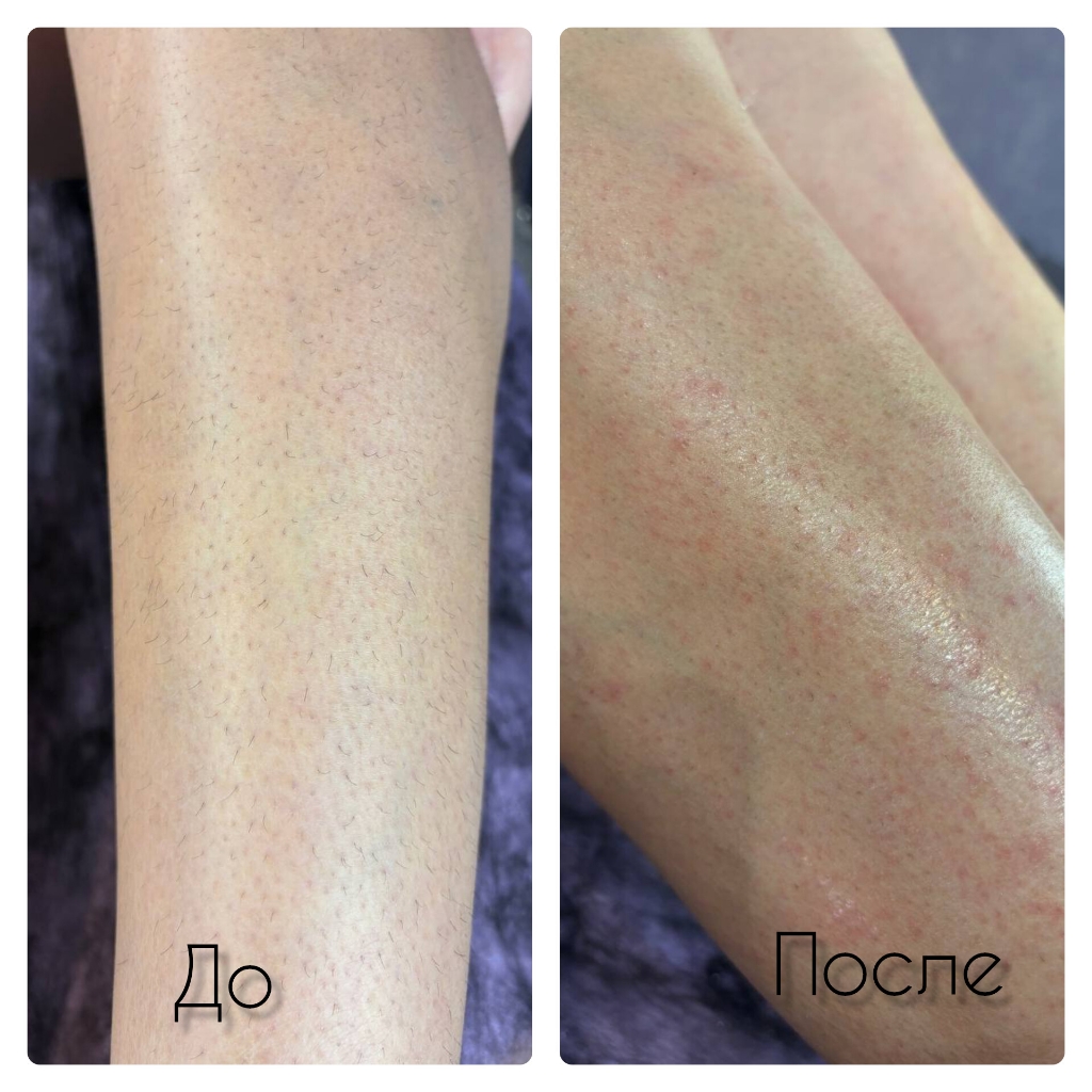 Голень/бедро