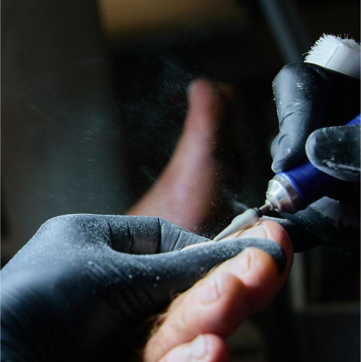 Мужской педикюр обработка только пальчиков