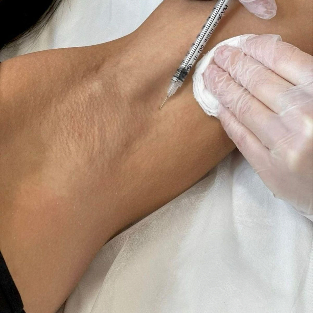 Botox гипергидроз Релатокс 200 ед