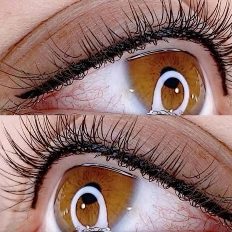 Заполнение межресничного пространства