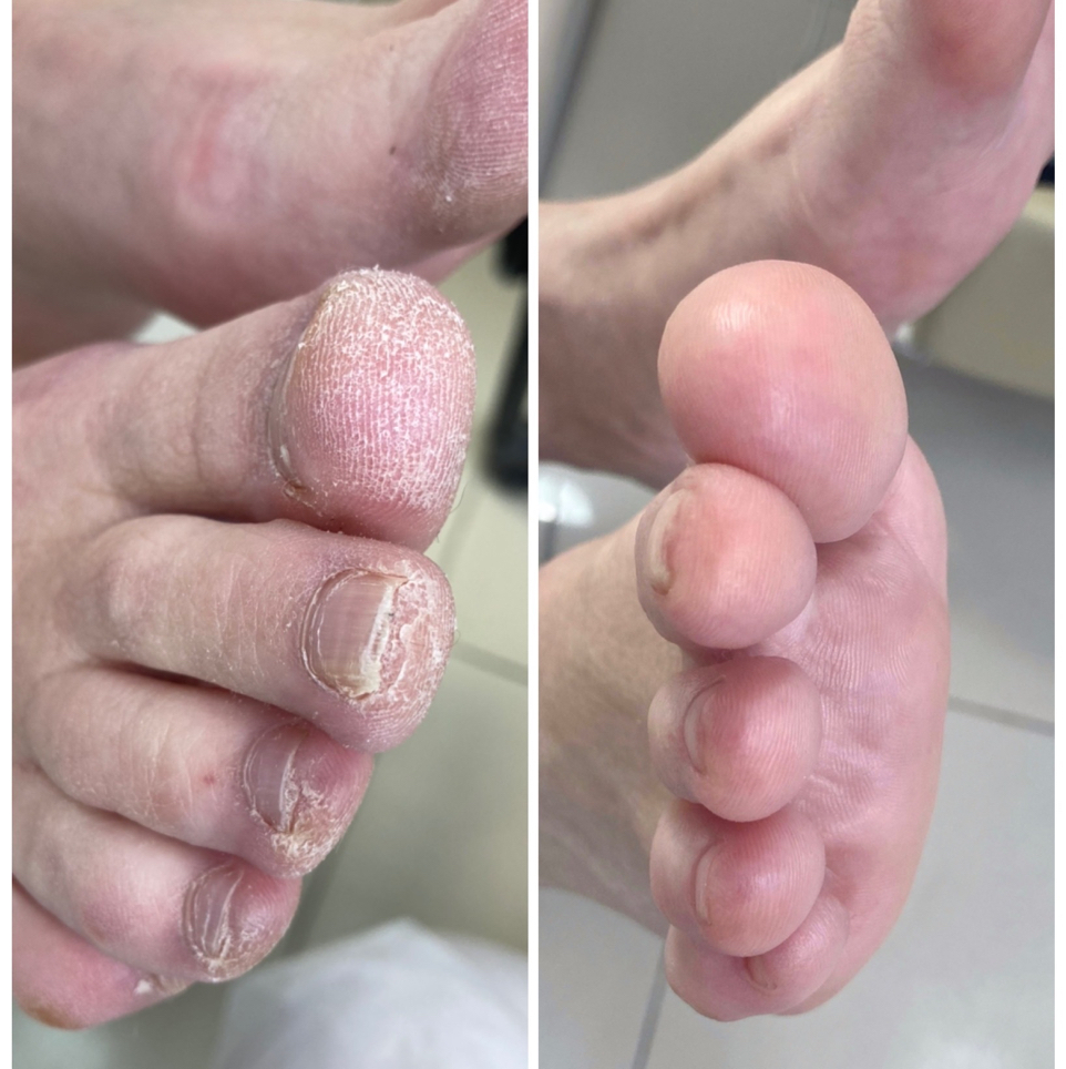 ПАП педикюр полный стопы и пальцы без покрытия