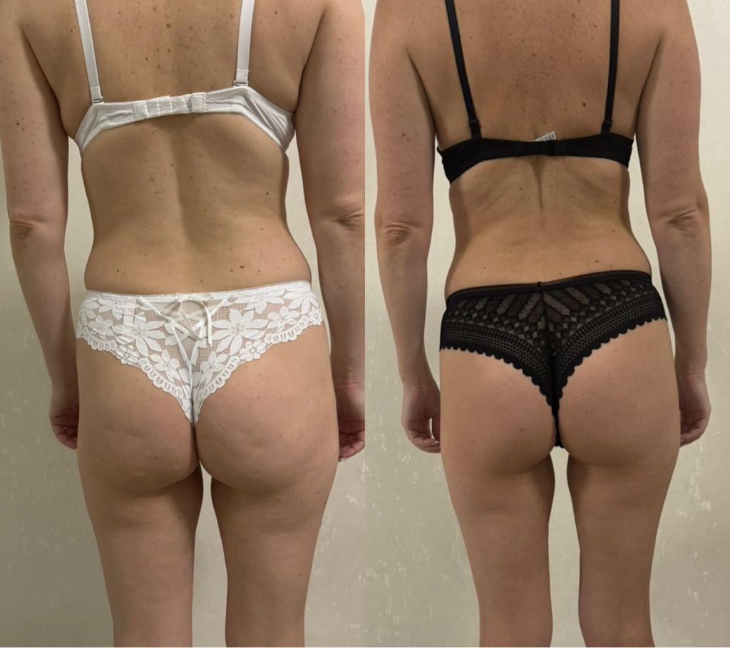 Абонемент Все включено( 20 сеансов -)