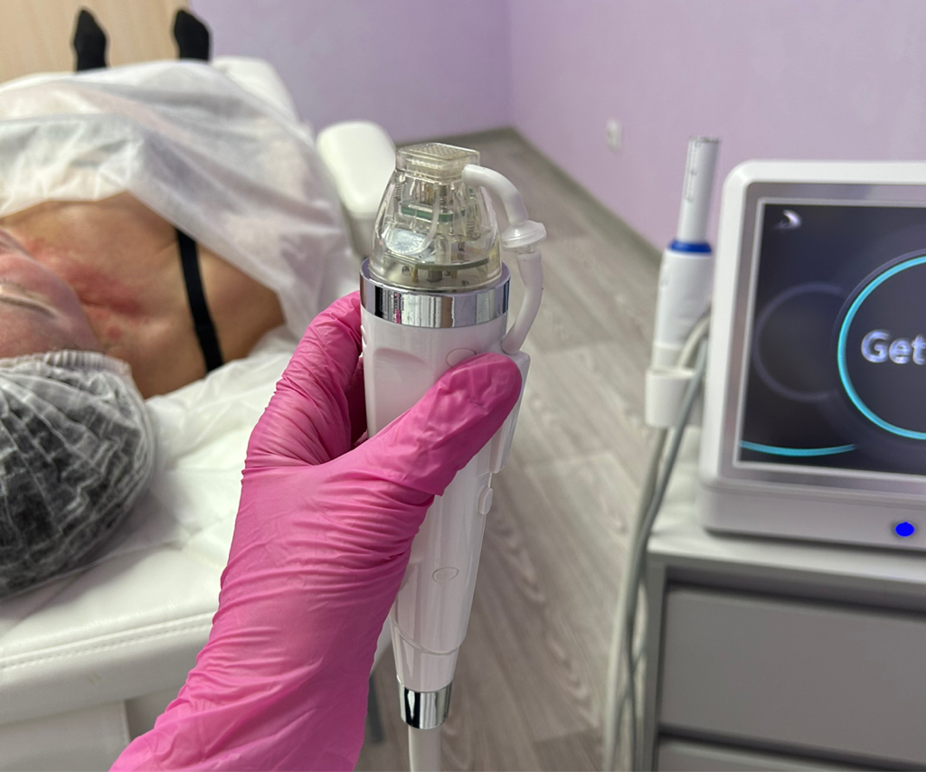 Игольчатый RF-лифтинг