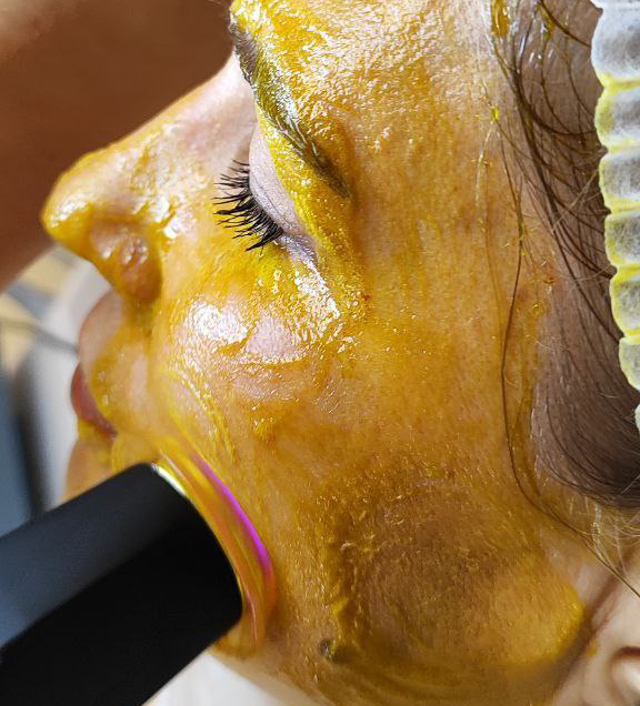 КАРБОКСИ АППАРАТНАЯ