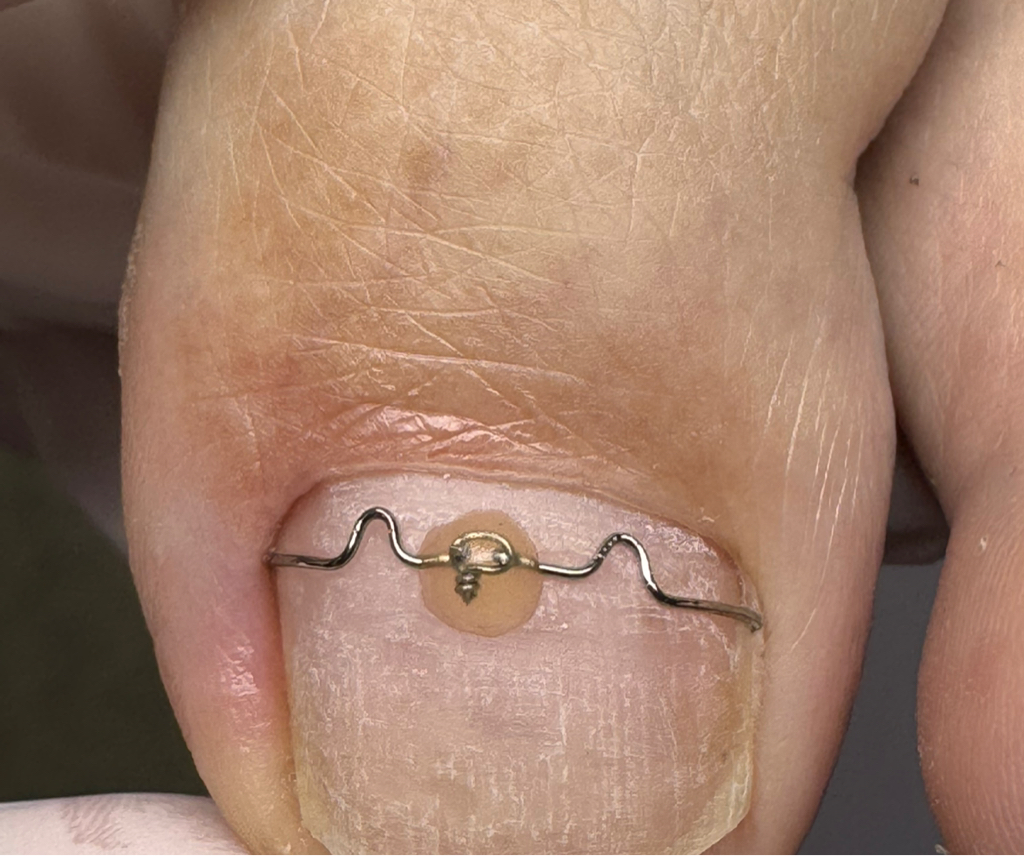 Подготовка ногтей к установке к/с 1 ед.