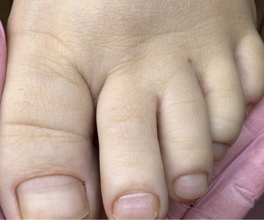 Педикюр пальцев/стоп(стопы/ногти не требуют подологической обработки)