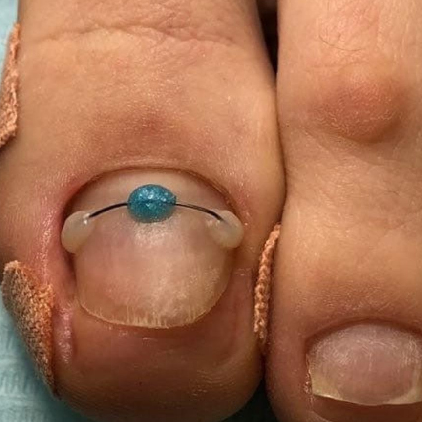 Система 3то