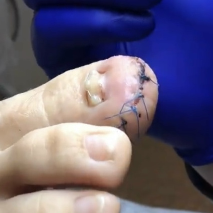 Перевязка+осмотр