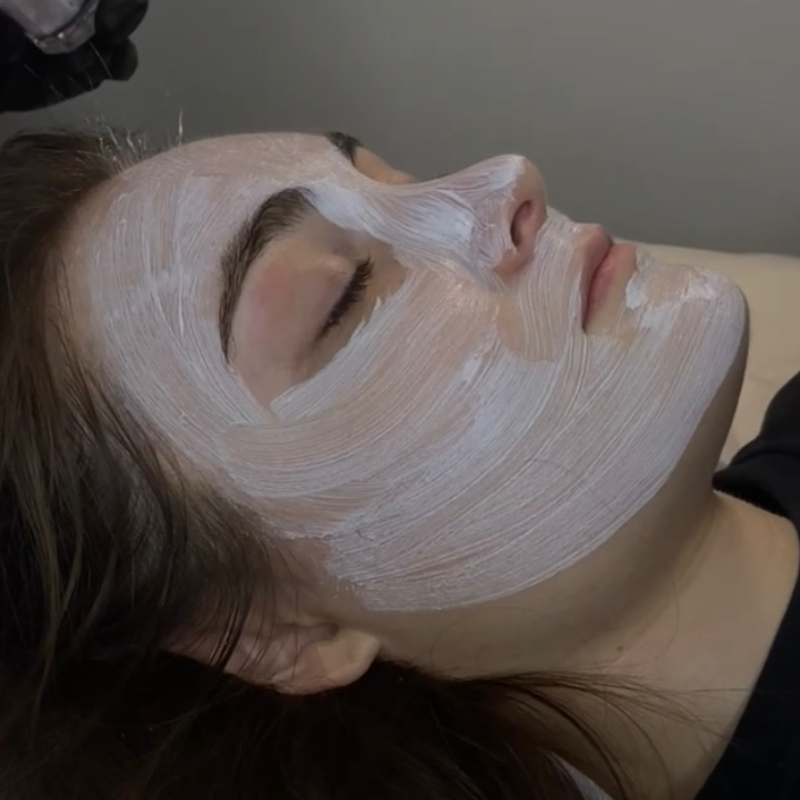 Гликолевый пилинг