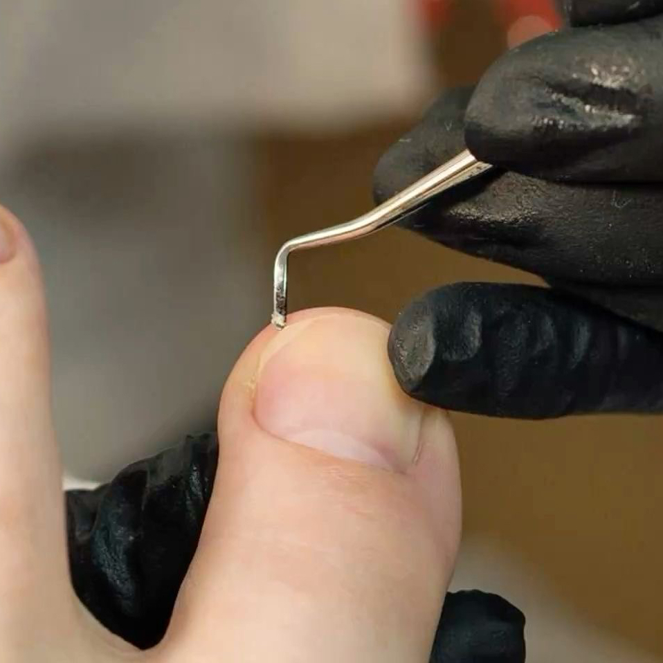 Консультация