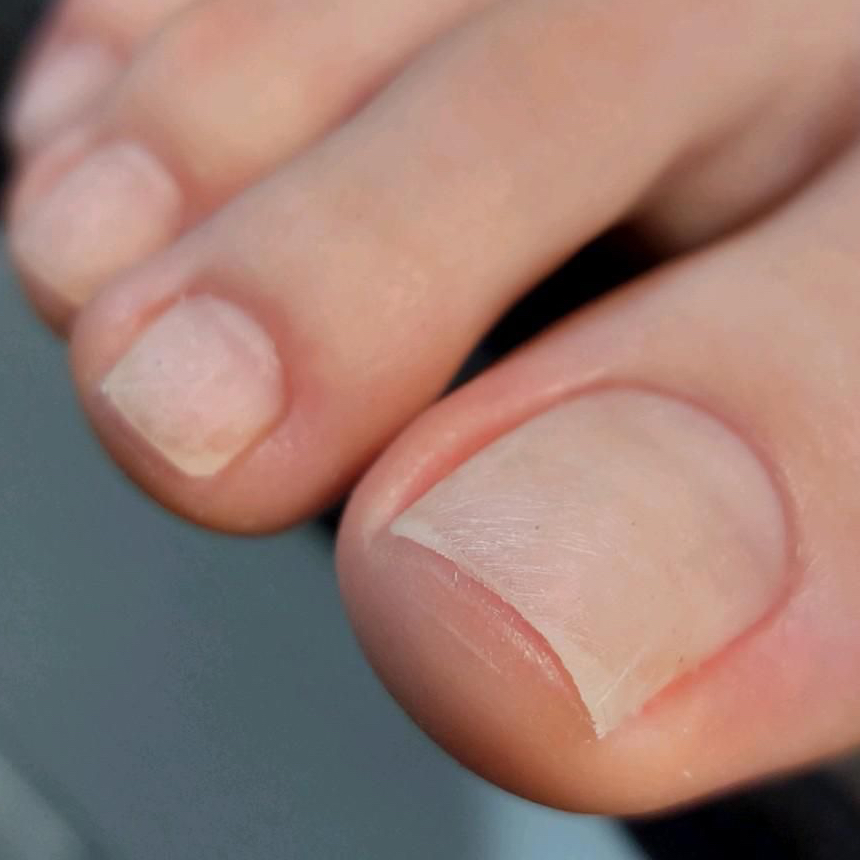 Педикюр обработка пальчиков 🔝мастер