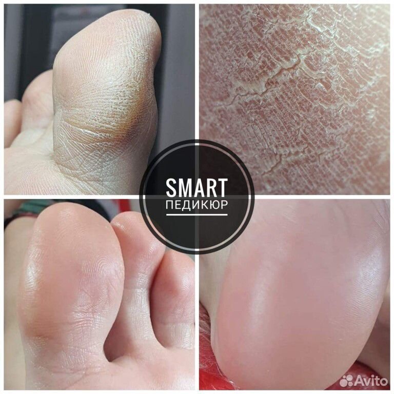 Смарт Педикюр, ( полная обработка)без покрытия и снятия