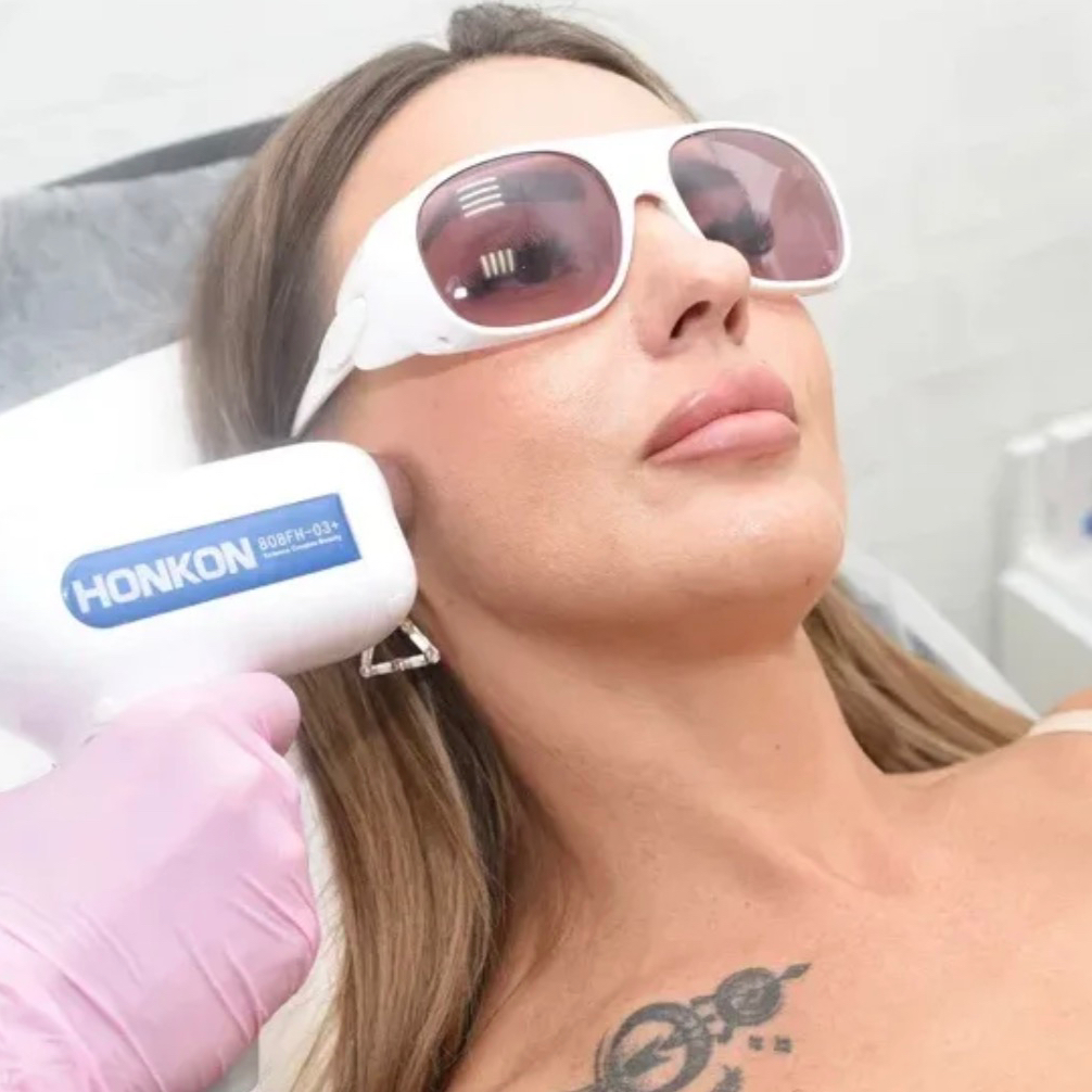 Бакенбарды