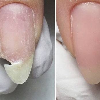 Ремонт 1 ногтя