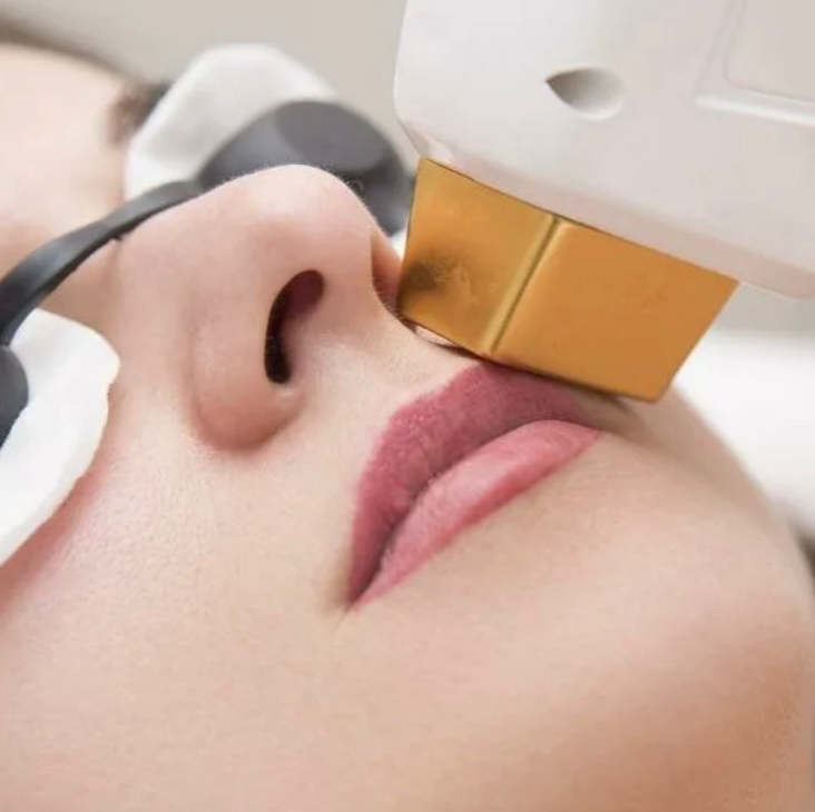 Верхняя губа