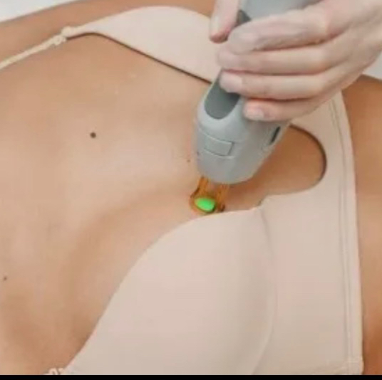 Зона ареолы